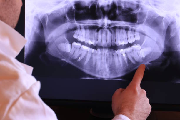 Best Broken or Cracked Tooth Emergency Dentist in West Hamburg, PA